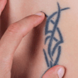 Austin Tattoo Removal is the best decision for your future